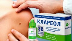 клареол от бородавок